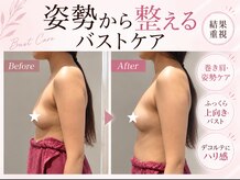 アンベリール(Embellir)