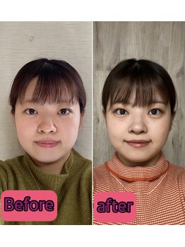 ノウ(nou)/小顔矯正/ヘッドスパ