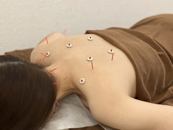 なつめ鍼灸ボディケアサロン/~全身鍼灸~