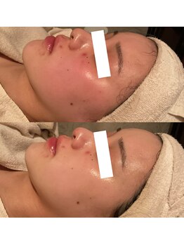 アンジェラックス 福岡天神店/