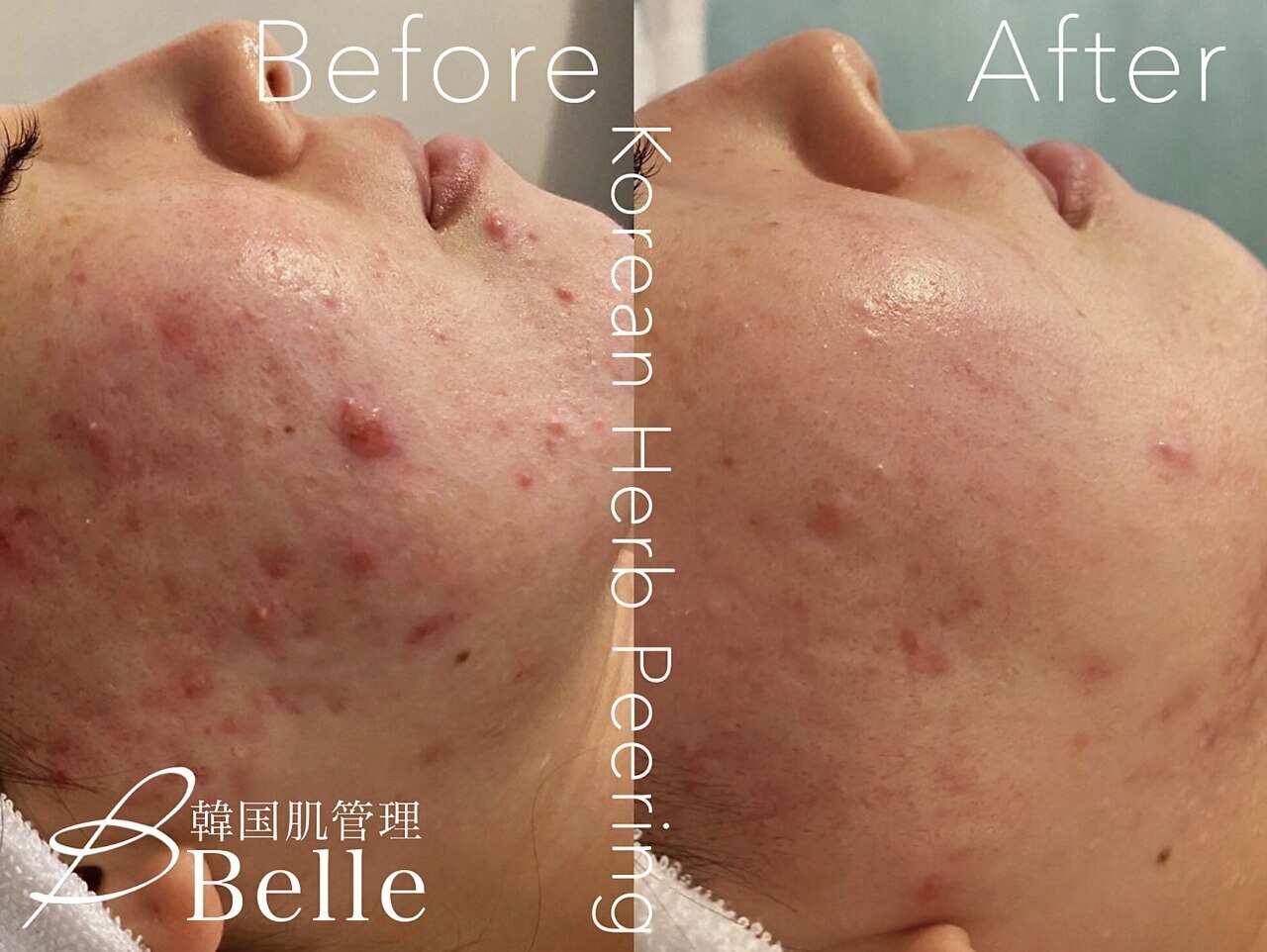 ベル 藤沢(Belle)｜ホットペッパービューティー