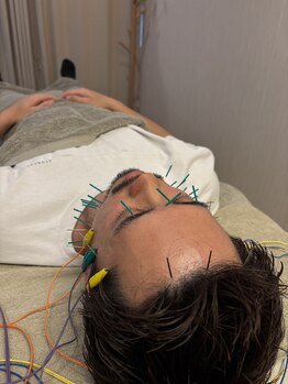 ナギ鍼灸院(nagi鍼灸院)/メンズ美容鍼