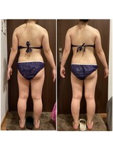 ソイズ 上中居店(SOIS)/痩身インドエステ