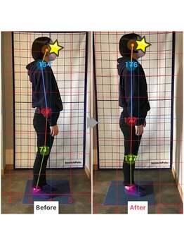 筋膜カッパ整体院 宮崎店/腰痛のお客様Before/After