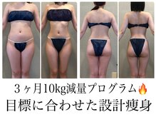 エクセレントビューティーサロン 艶(EN)の雰囲気（ハイパーナイフコンプリートサロンVENUS LEGACY減量プログラム）