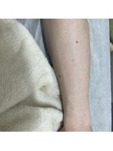 ナノハナ/鹿沼市の全身脱毛美容室ナノハナ