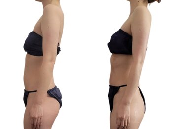 ティティビューティ ラ・クエージ金山(TTBeauty)/