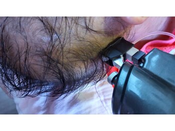 エステティック パルフェ/頭皮でお悩みの方インディバとAC