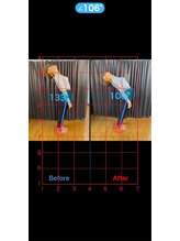 やぎはし整体院 柏駅東口店/姿勢ビフォーアフター