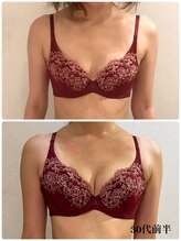 リール 新宿店(RIRE)/30代前半　バストアップ症例