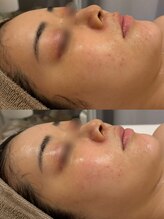 セレニテ(Serenite)/