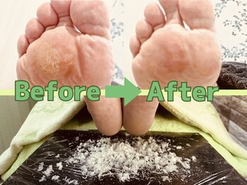 フットルーム プラナ 栄店/角質ケアができるサロン