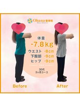オハナ整骨院(Ohana整骨院)/30代　－7.8キロダイエット