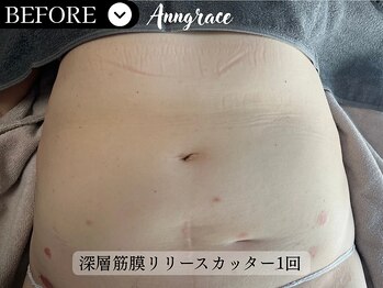 アングレイス(Anngrace)/【リリースカッター】Bfore