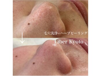 リベルキョウト 京都駅前店(Liber Kyoto)/毛穴レス艶肌コース