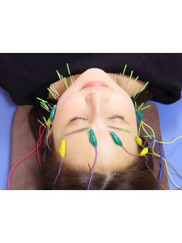 小顔になりたい