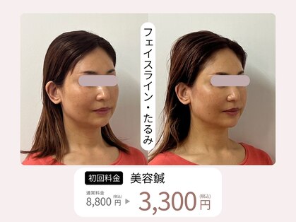 コガオ レンネ(Lenne)の写真