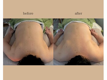 エン(en)/リンパ・骨格・神経系に働きかけ