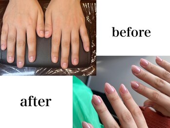 レイシア(Raysia)の写真/お爪の健康を第一に♪【爪が薄い・弱い・綺麗に伸ばしたい方】も潤いケアで持ちの良さを実感！巻き爪にも◎