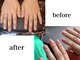 レイシア(Raysia)の写真/お爪の健康を第一に♪【爪が薄い・弱い・綺麗に伸ばしたい方】も潤いケアで持ちの良さを実感！巻き爪にも◎