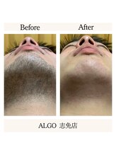 アルゴ 志免店(ALGO)/アットホームを重視した店舗☆