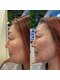 サロンノコ(salon NOKO)の写真/【脂肪分解で速攻リフトアップ】エアインジェクションで話題の美容液を導入◎効果は半永久的★