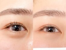 リベラ(Rivera)/上下ラッシュリフト