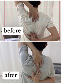 ナオル整体 仙台長町院(NAORU整体)/整体・矯正ビフォーアフター