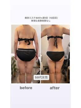 トランキーロ(Tranquilo)/痩身60分×週1回ペース　12回目