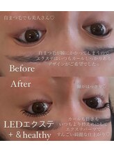 グロウ アイラッシュ(grow eyelash)/＆healthy