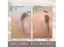 モアトゥインクル 福山神辺店(MORE twinkle)の雰囲気（《Instagram⇒@moretwinkle_kannabe》症例多数載せています！）