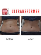 アップルミント/＜痩身＞before・after