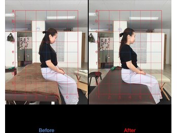 ストレチックス 近江八幡店/BeforeAfter
