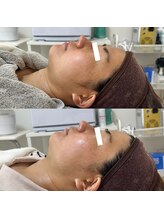 ラ フルール(La Fleur)/小顔フェイシャルマッサージ