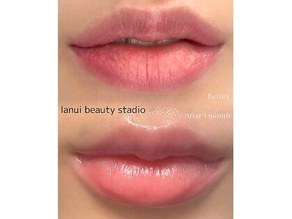 ラヌイ(LANUI)の写真