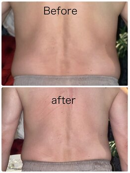 ルミネル 名古屋新栄(Luminelle)/BODY上半身