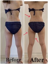 スペチアーレ 夙川/スッキリ美ボディに