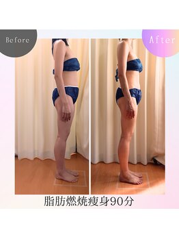 クリオネ(Clione)/姿勢から綺麗に!!