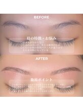 クリル(Kuril)/ビフォーアフター20代女性♪