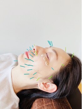 小顔になりたい