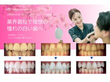 ホワイトニングショップ 三田店