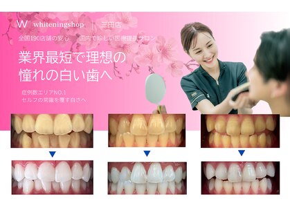 ホワイトニングショップ 三田店の写真