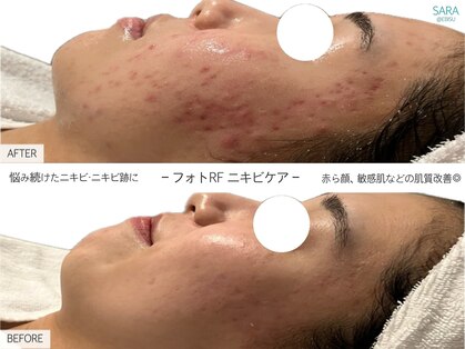 サラ 恵比寿店(SARA)の写真