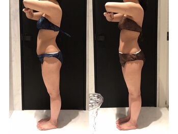 リボディ 表参道(An re Body)/before→after