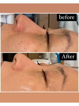 アンジェロ(Angelo)/期待以上の仕上がりです。