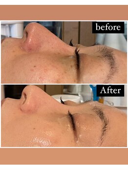 アンジェロ(Angelo)/期待以上の仕上がりです。