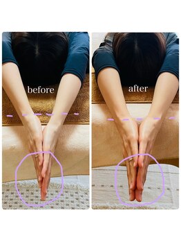 アリス(Alice)/美姿勢矯正