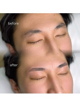 レアファースト/メンズハリウッドブロウリフト