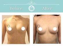 美人バスト 那覇店の雰囲気（【育ちづらい原因を徹底解明】育乳のプロがバストアップを実現♪）