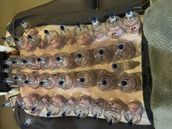 柔整 おがわ屋の写真/【カッピング×全身整体70分5000円】落ち着く和モダン空間で“深部疲労”にアプローチ◇疲れをリセット♪